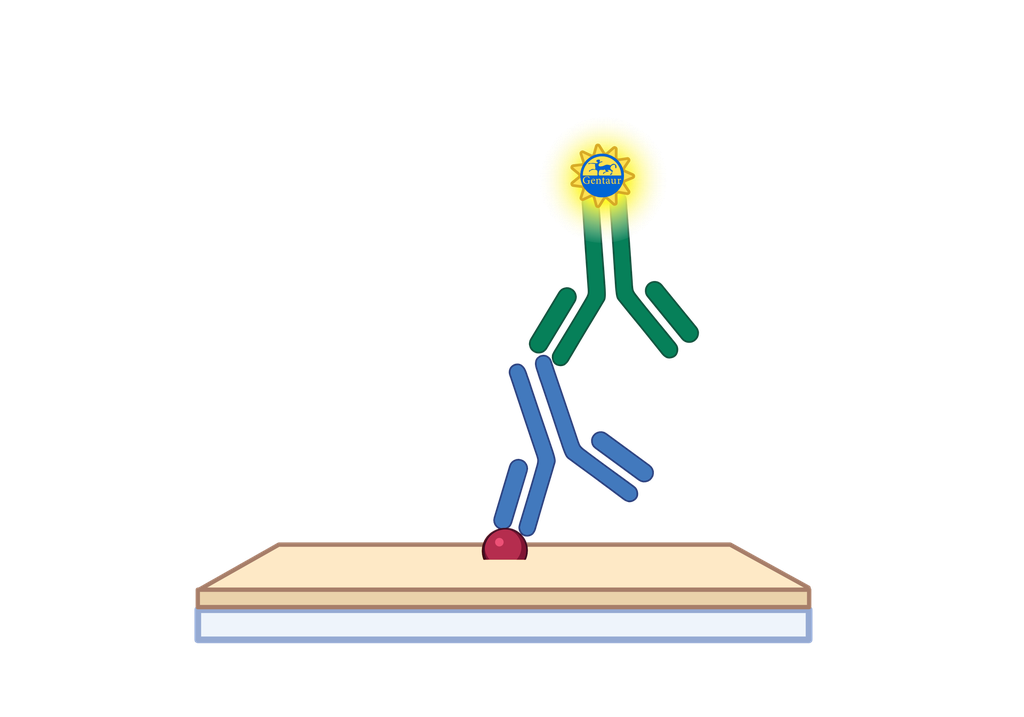 ELISA   ACADVL Antibody, HRP  